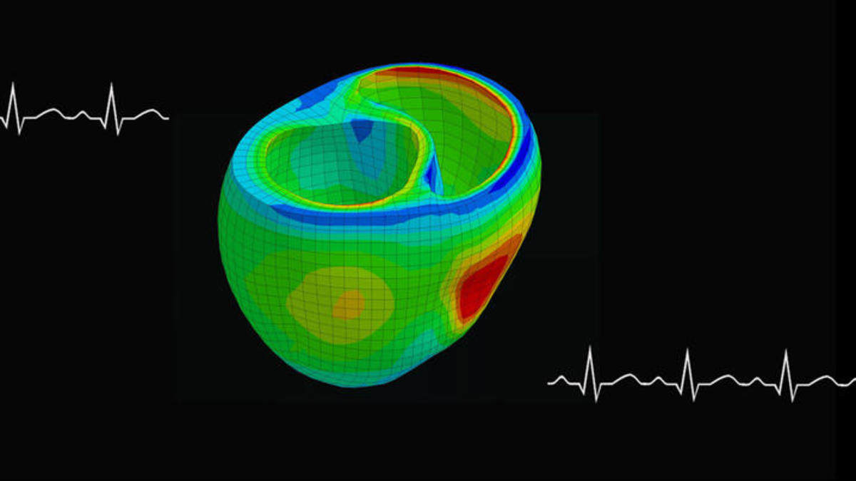Computer model of a heart